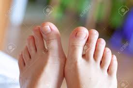 toes toes